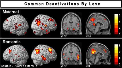 brain and love